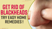 Remedies To Remove Blackheads