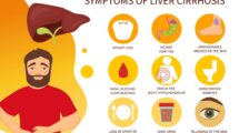 Liver Cirrhosis